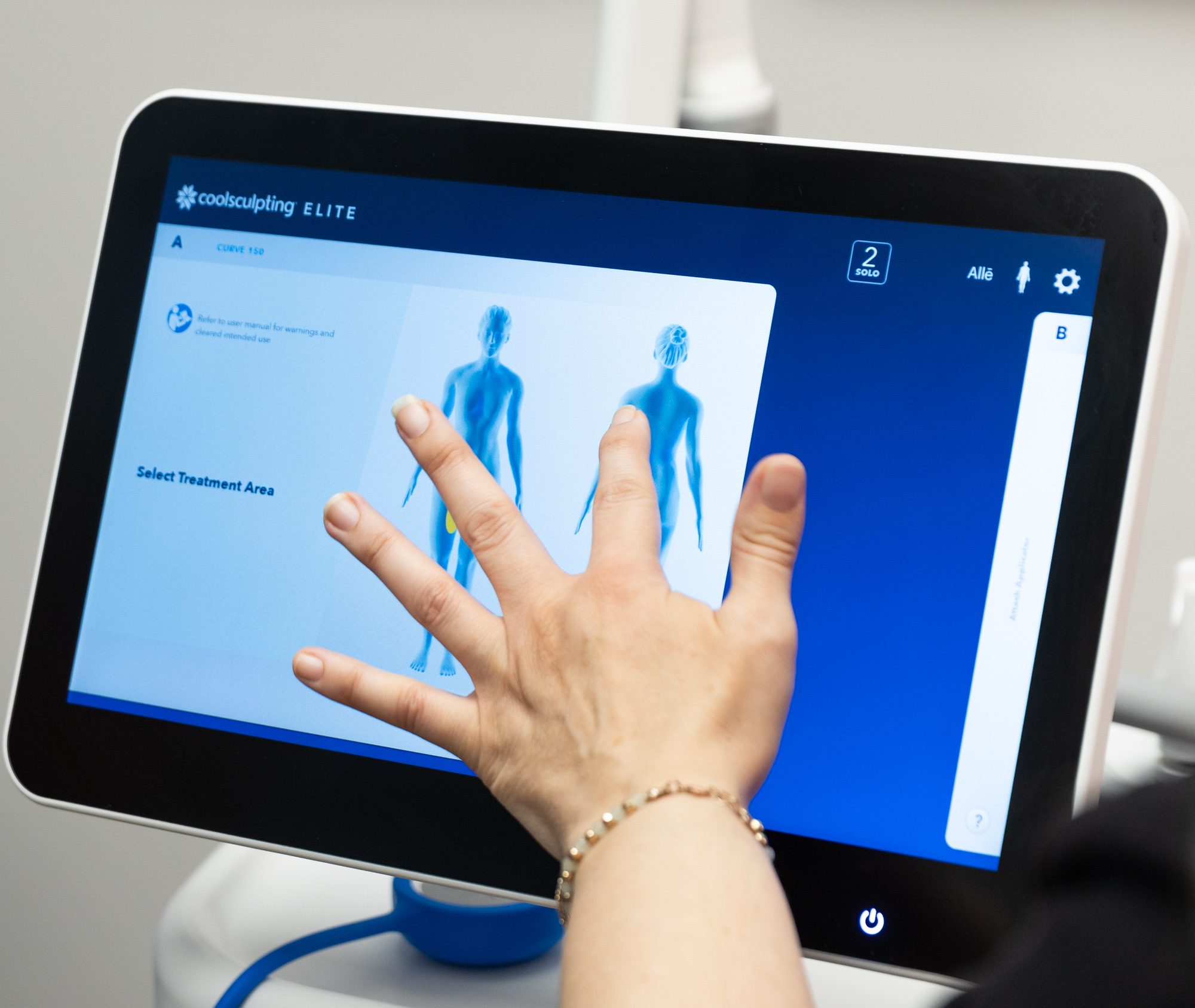 CoolSculpting Elite screen selecting treatment area