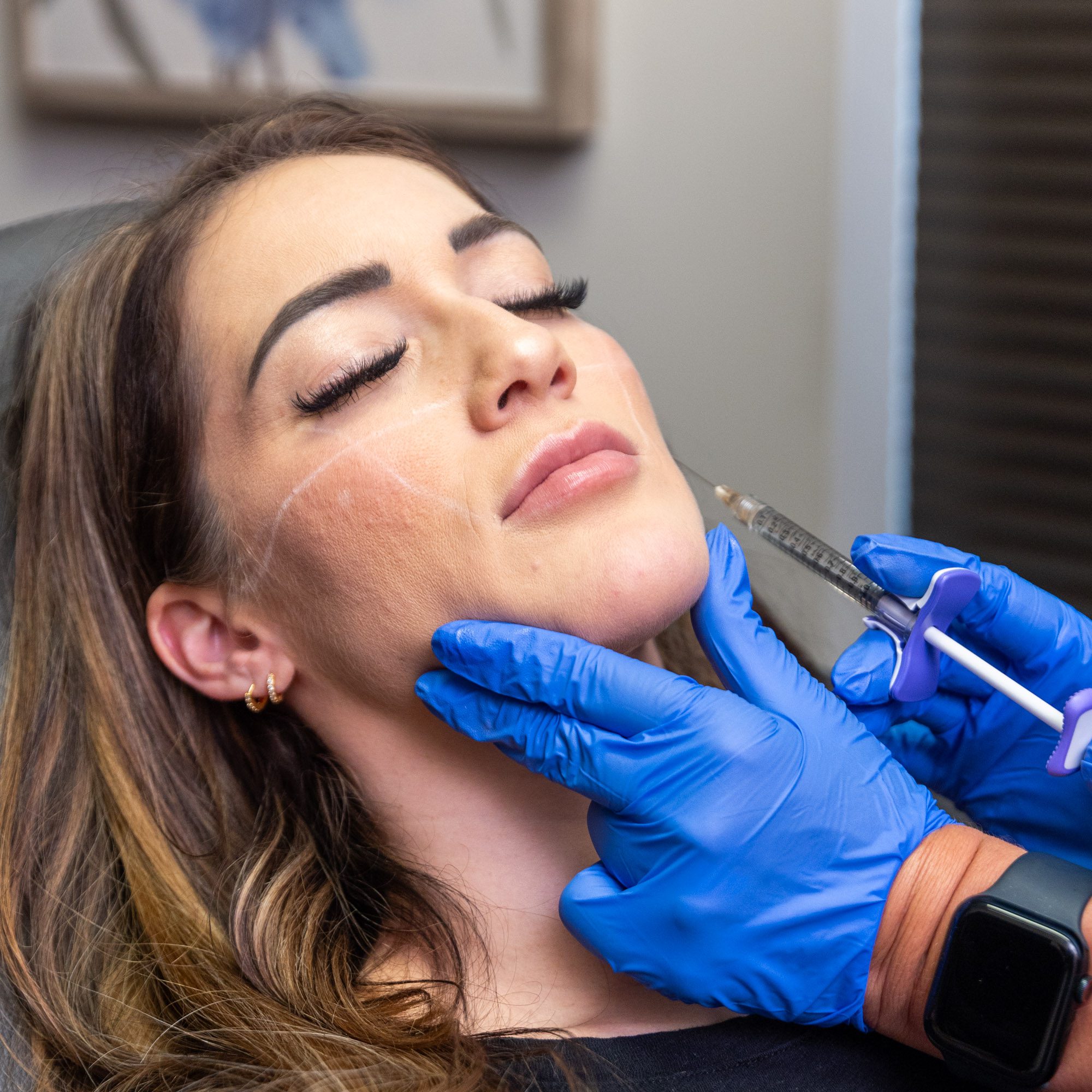 Woman receiving facial filler injection procedure