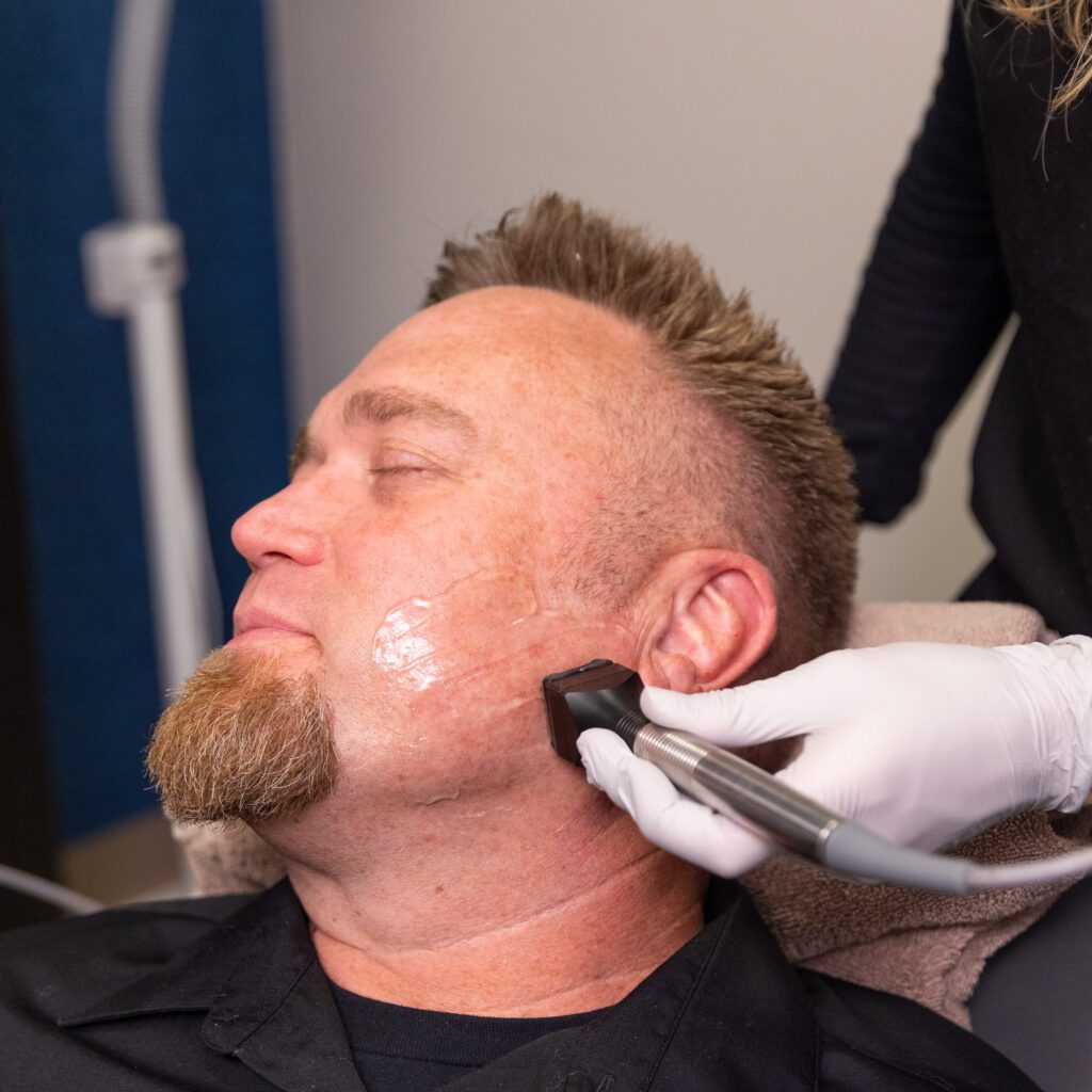 Man receiving facial rejuvenation treatment