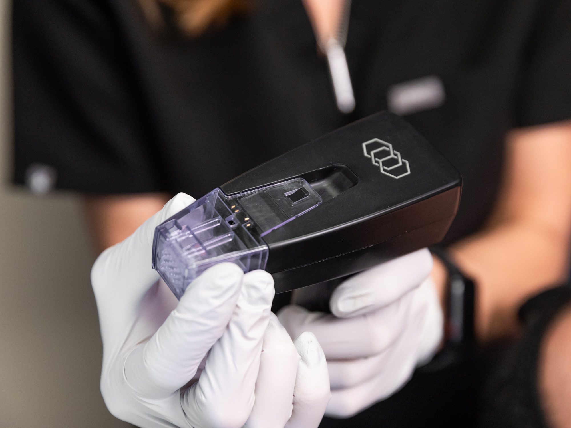 Technician holding a skin treatment device wearing white gloves.