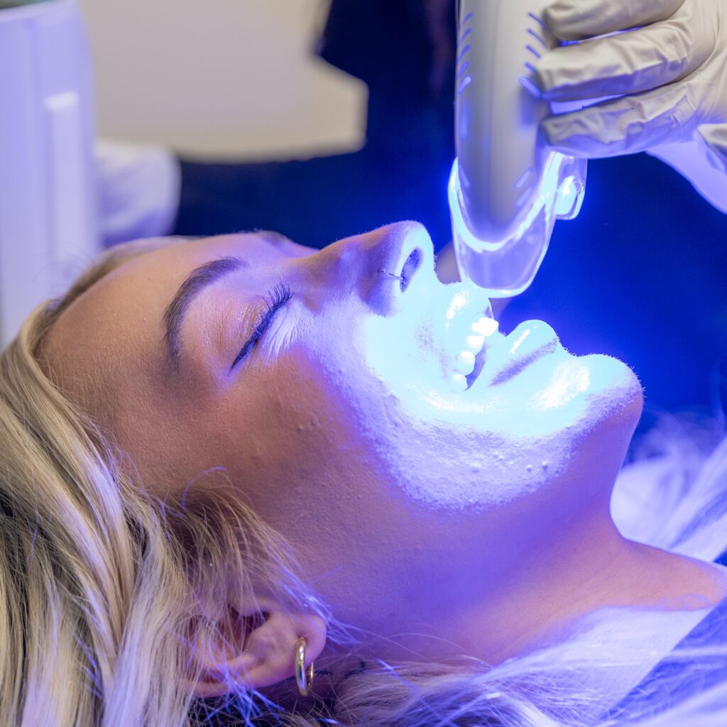 Teeth whitening procedure with blue light