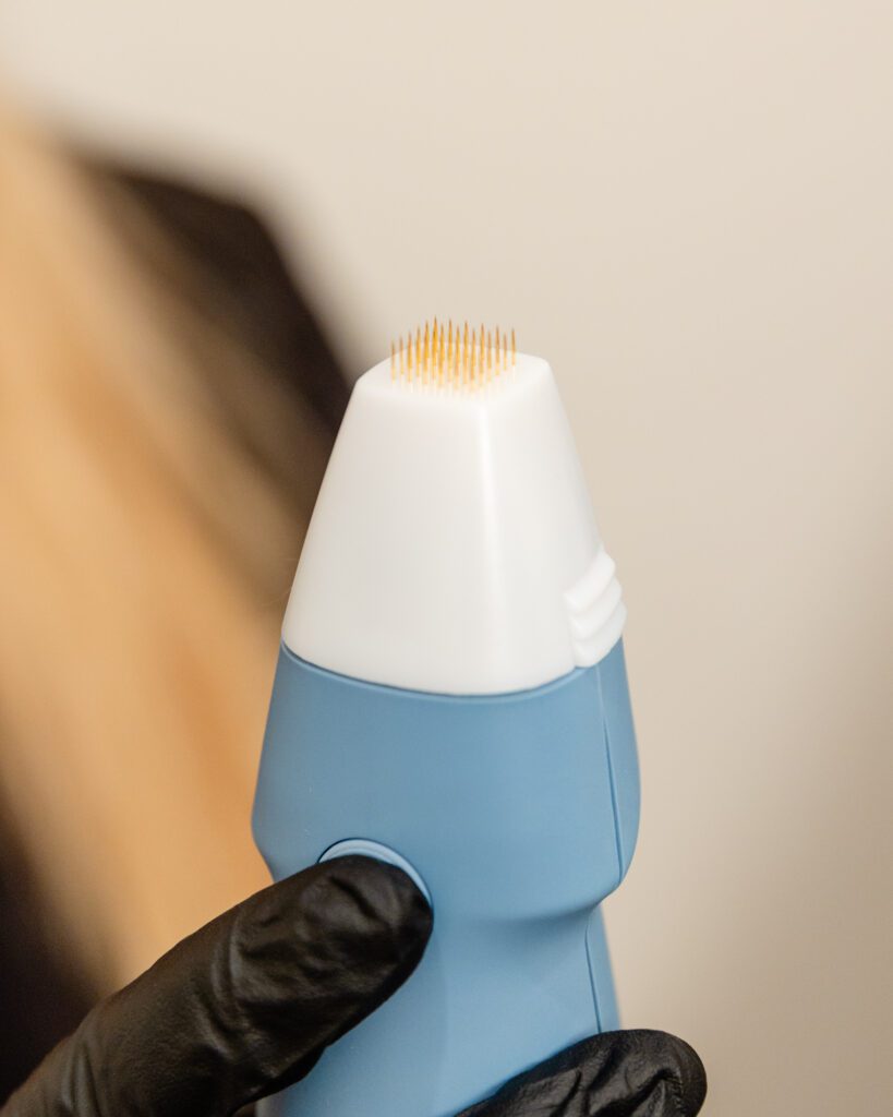 A woman is holding up the RF Microneedling applicator for Exion in Fort Collins.