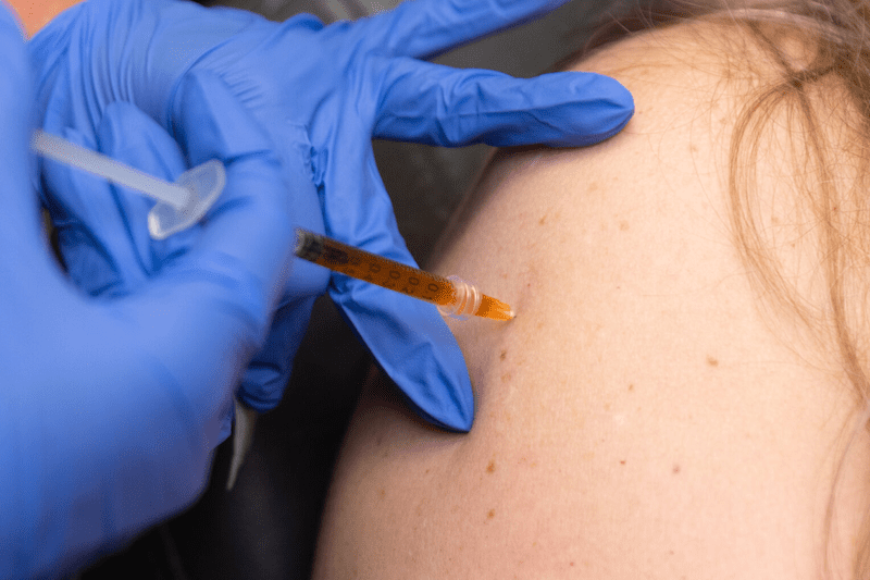 Close-up of injection being administered into skin by gloved hands.