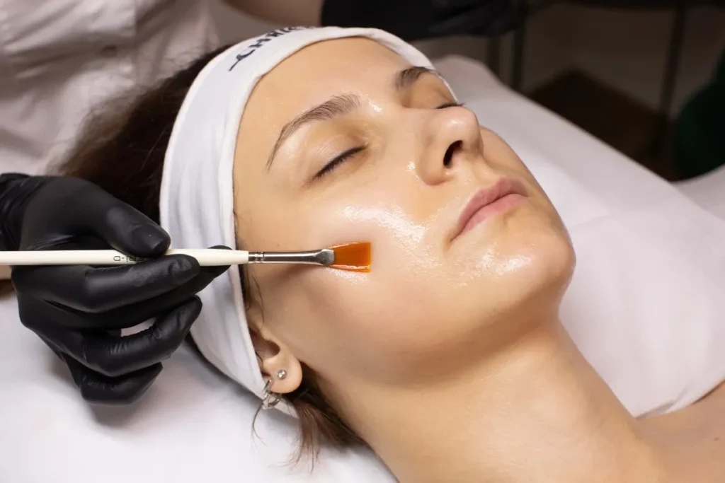 Woman Getting Chemical Peel Treatment at Xanadu Med Spa in Fort Collins, CO