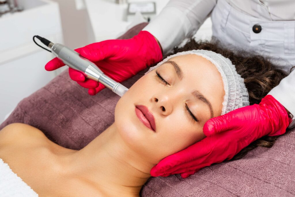 microneedling