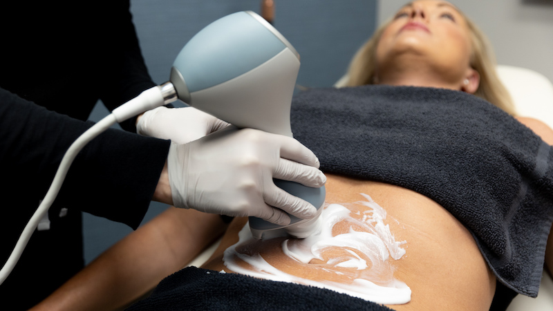 A beautiful woman receiving Emtone treatment on her stomach at the body sculpting center in Fort Collins