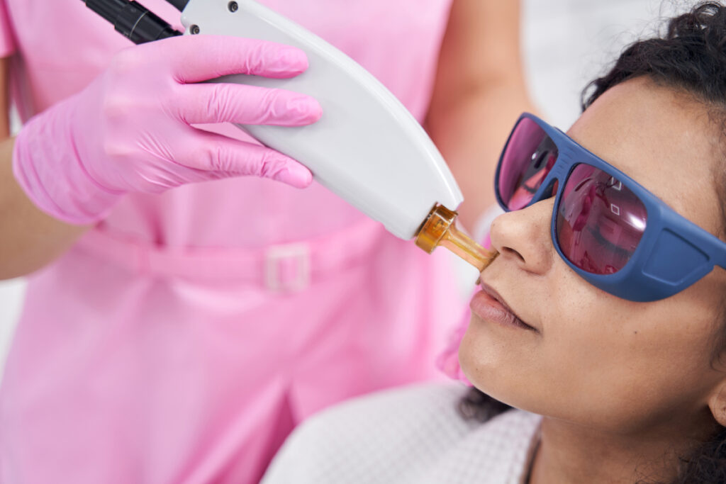 A woman is having laser hair removal done on her upper lip for facial hair removal in Fort Collins