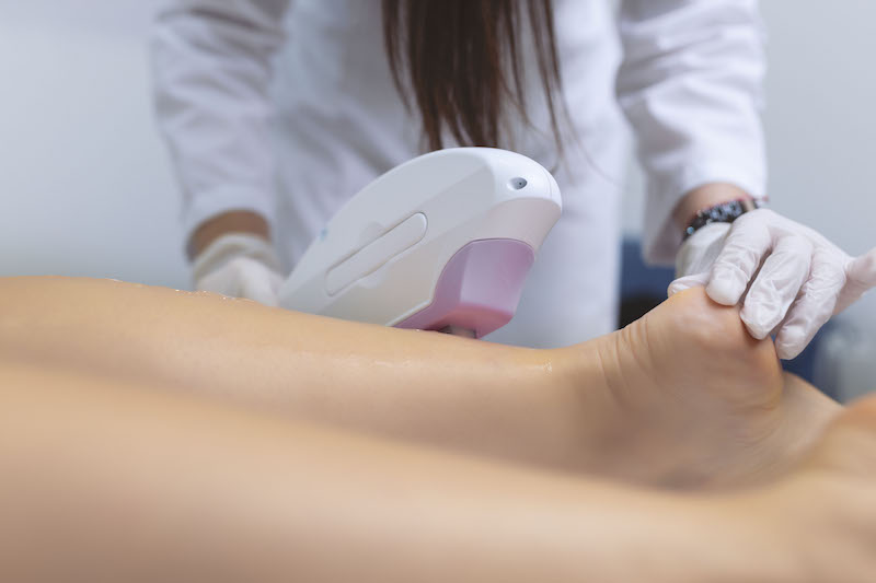 A woman is lying down on her stomach and a laser technician is applying a laser device to her legs for laser hair removal near Fort Collins