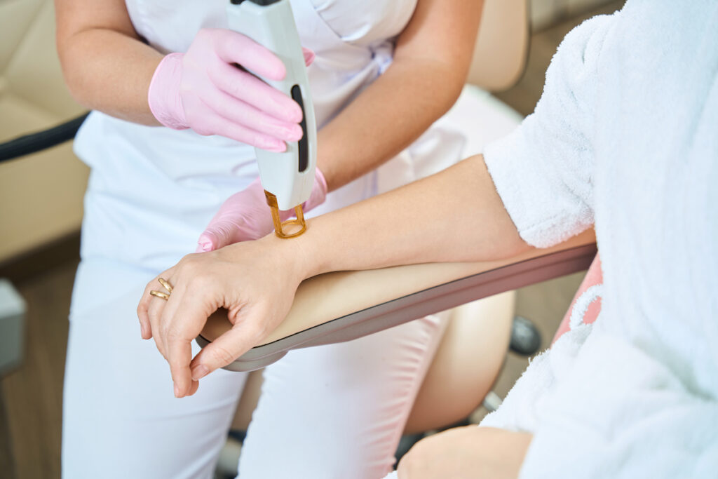 A woman is sitting in a chair and a laser technician is apply a laser to her arm for laser hair removal near Fort Collins